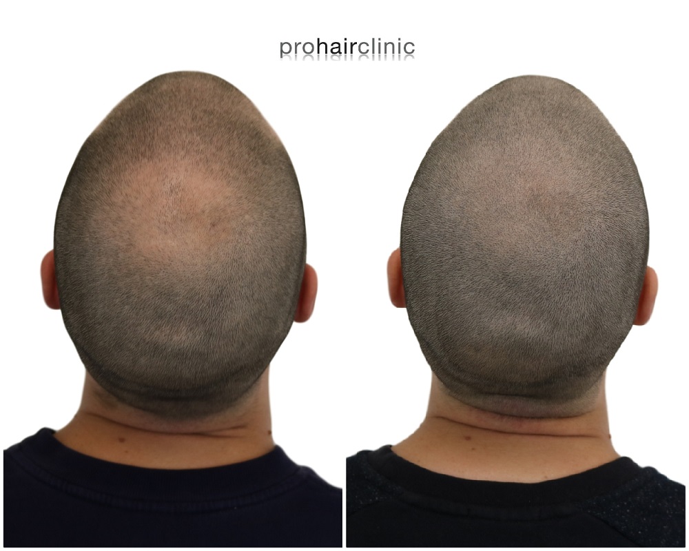 /foren/transplant/index.php/fa/44184/0/