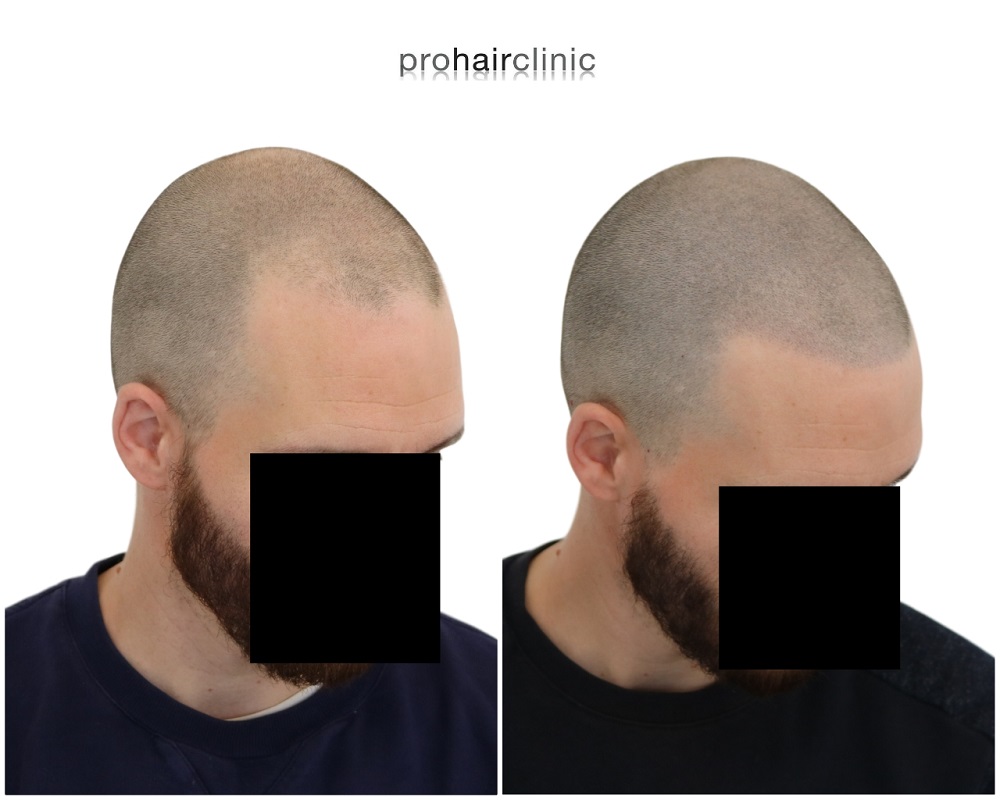 /foren/transplant/index.php/fa/44186/0/