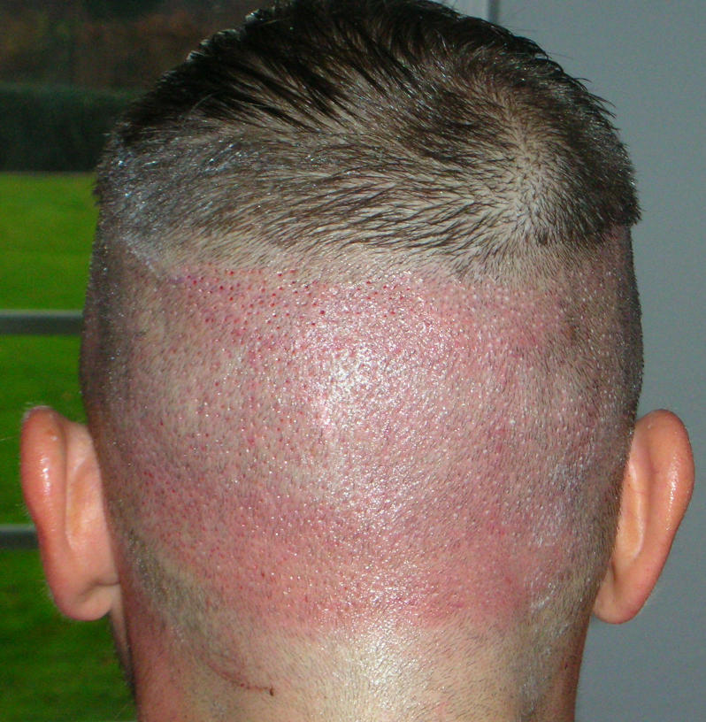 index.php/fa/4423/0/