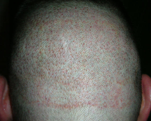 index.php/fa/4425/0/