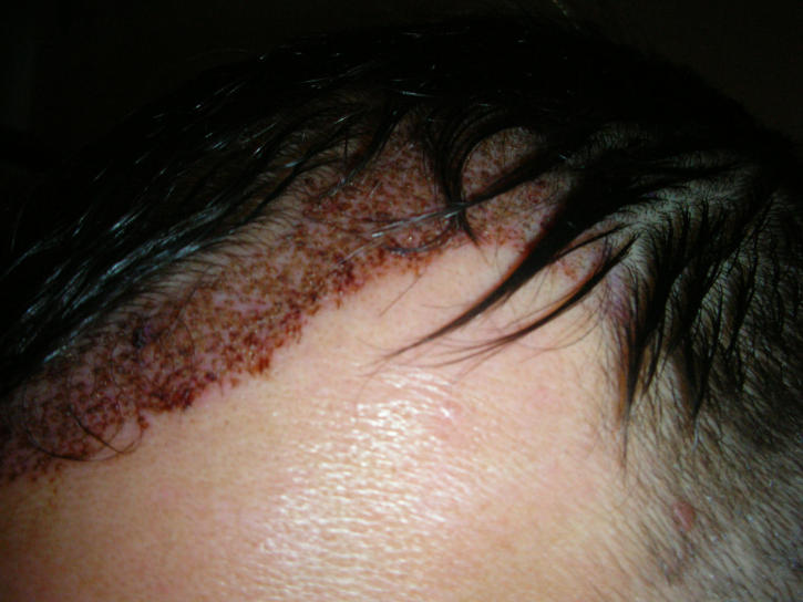 index.php/fa/4426/0/