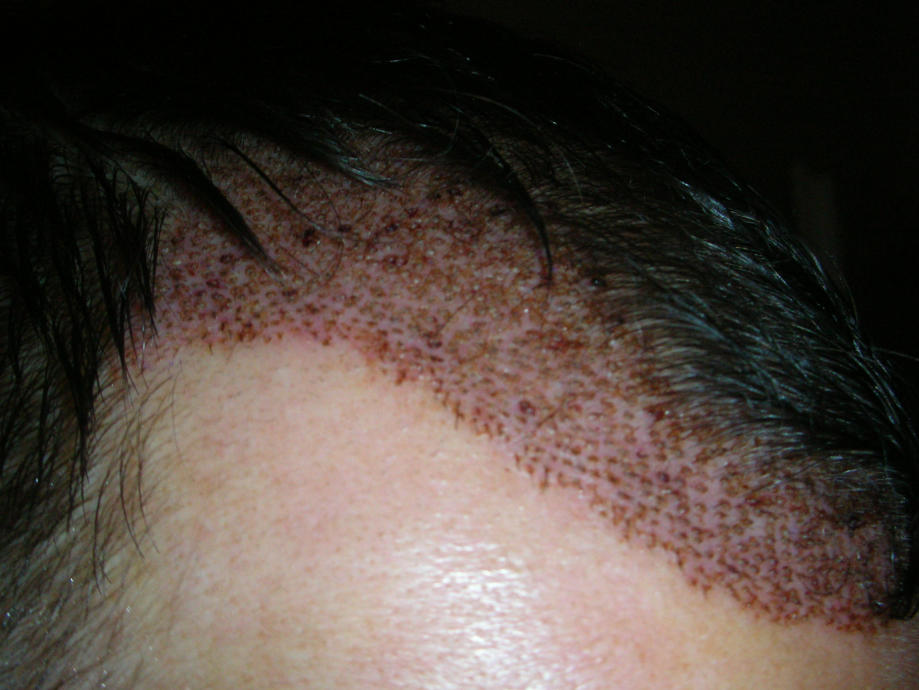 index.php/fa/4427/0/