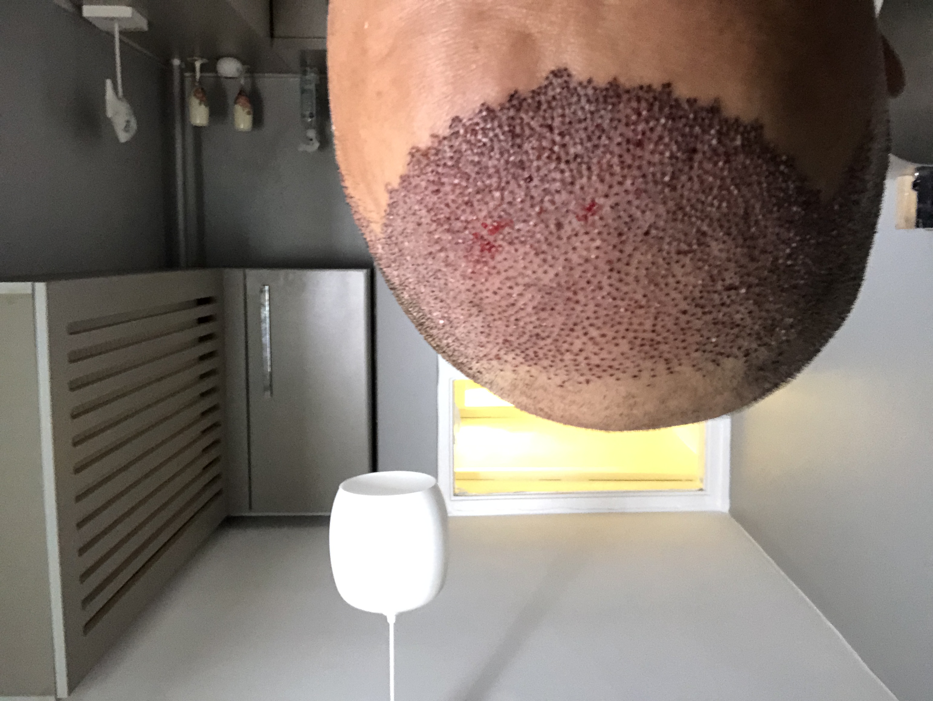 /foren/transplant/index.php/fa/44307/0/