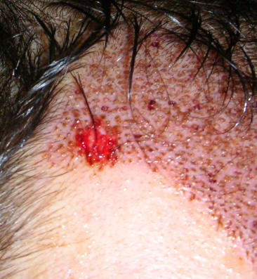 index.php/fa/4431/0/