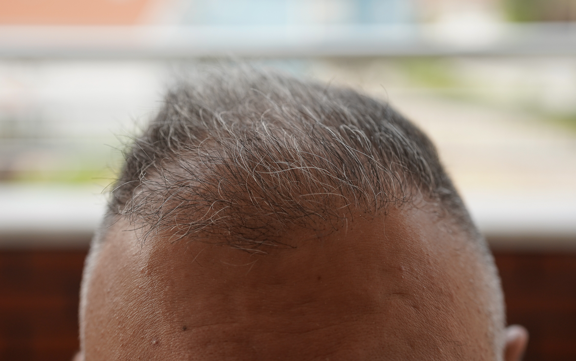 /foren/transplant/index.php/fa/44310/0/