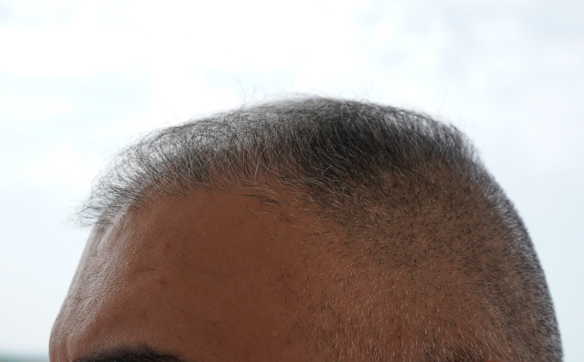 /foren/transplant/index.php/fa/44311/0/