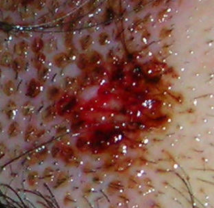 index.php/fa/4432/0/