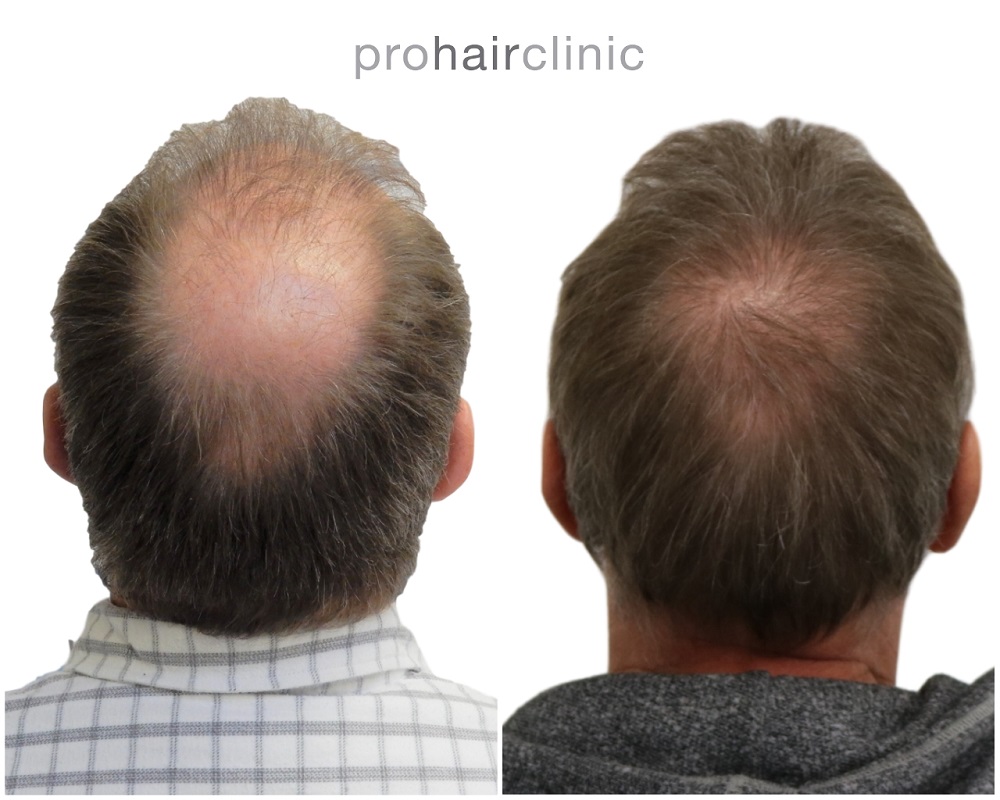 /foren/transplant/index.php/fa/44320/0/