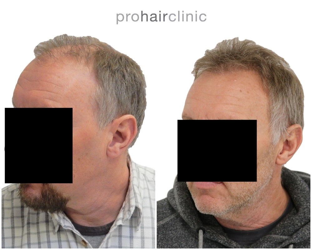 /foren/transplant/index.php/fa/44321/0/