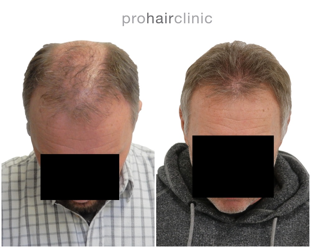 /foren/transplant/index.php/fa/44323/0/