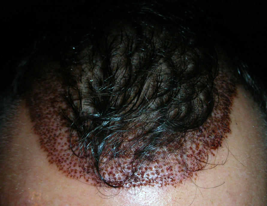 index.php/fa/4460/0/