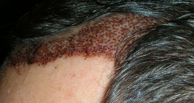 index.php/fa/4461/0/