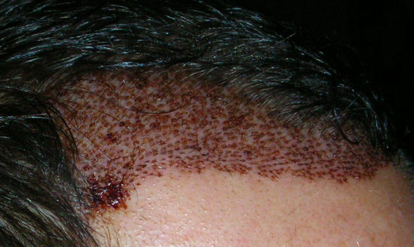 index.php/fa/4462/0/