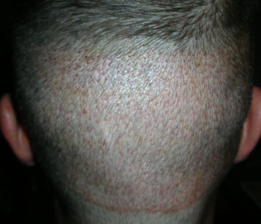 index.php/fa/4463/0/