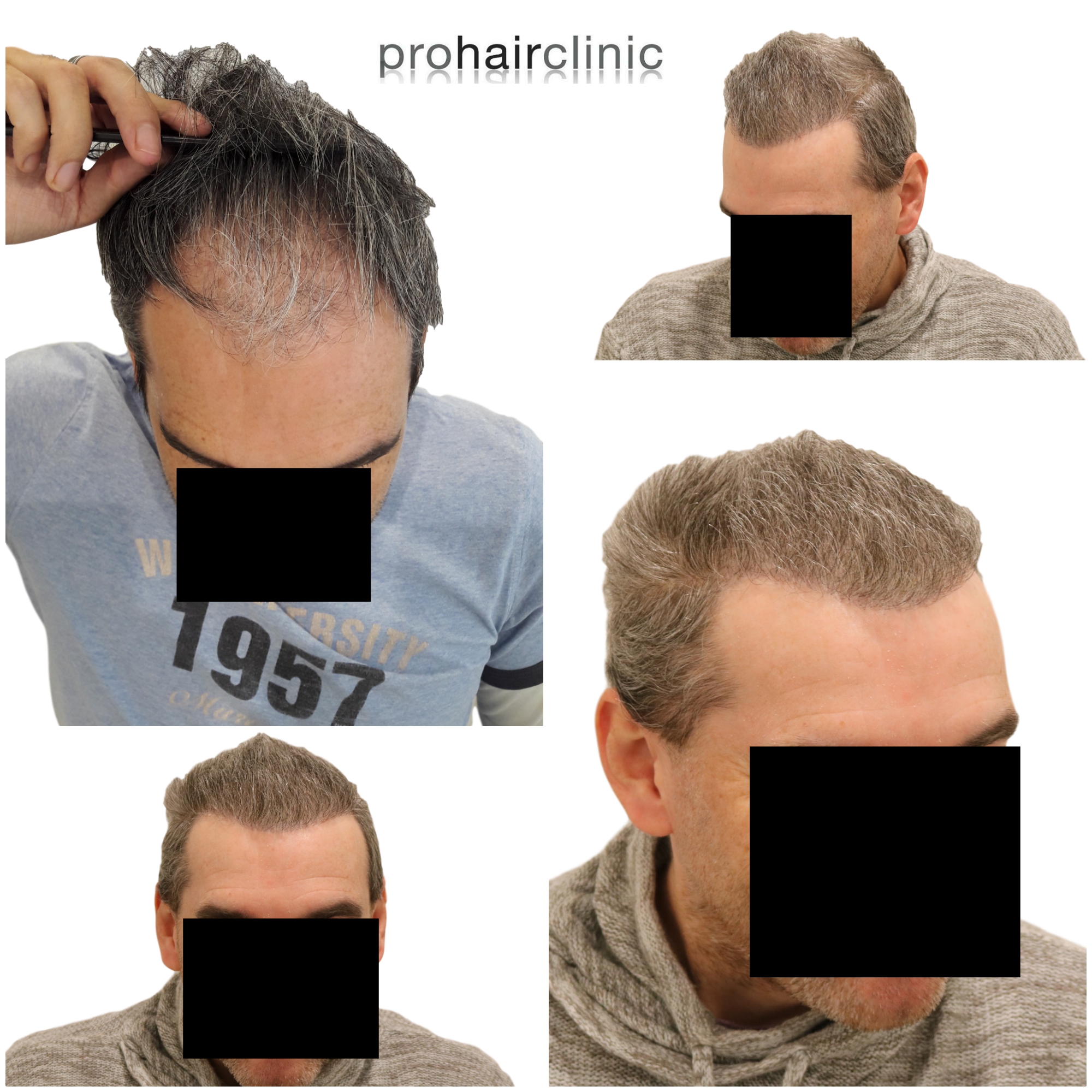 /foren/transplant/index.php/fa/44643/0/