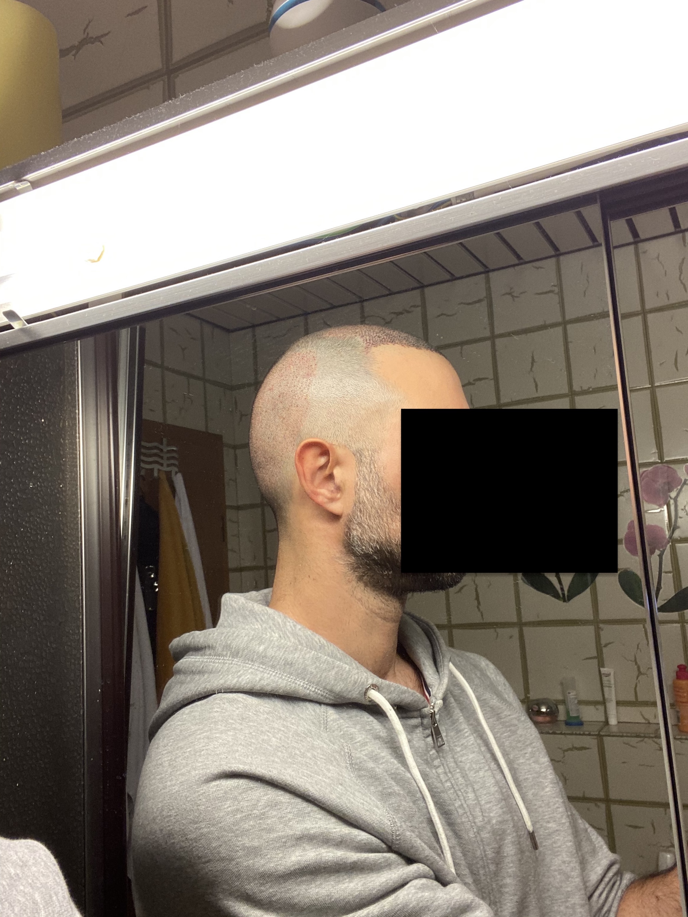 /foren/transplant/index.php/fa/44680/0/