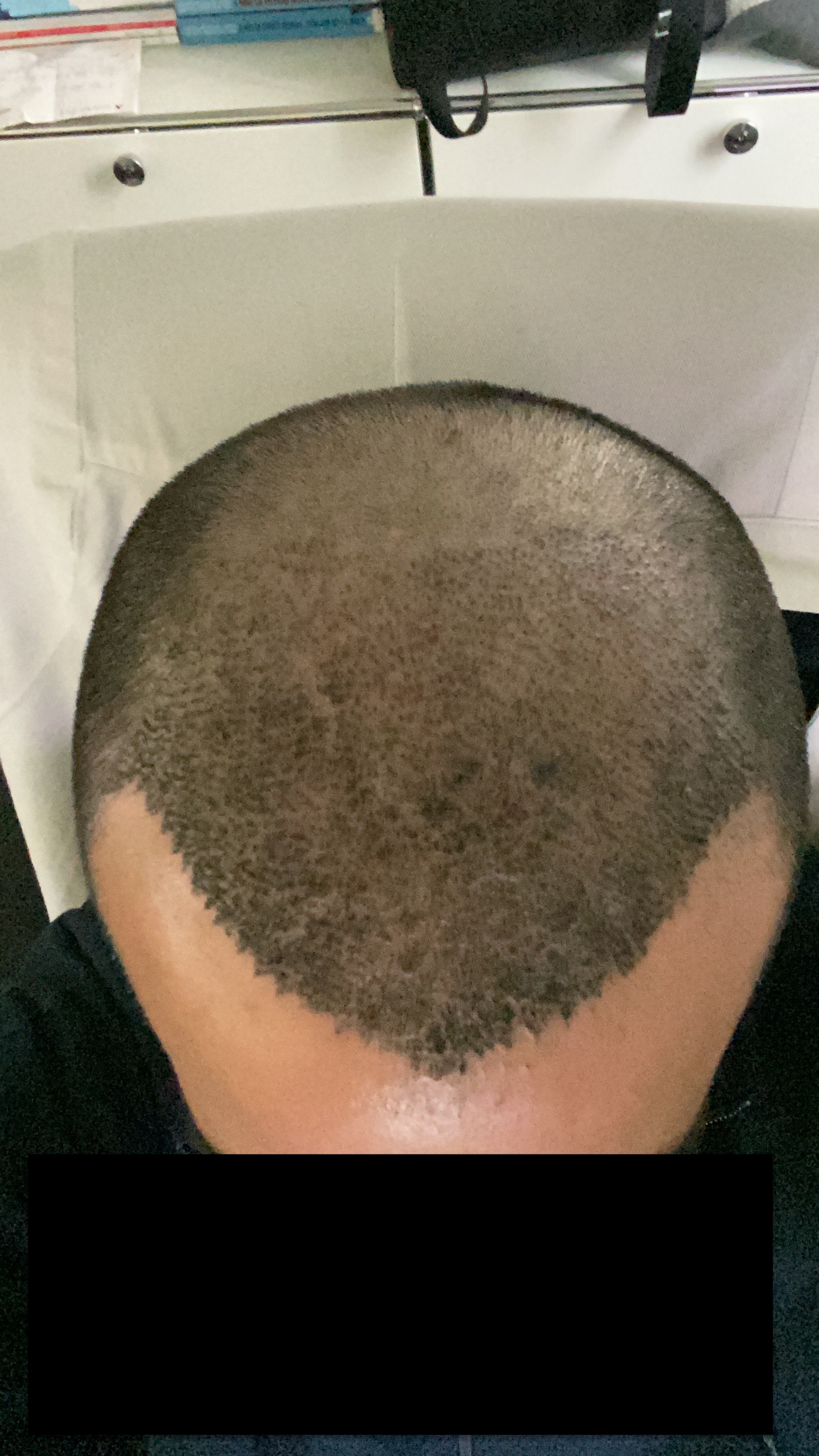 /foren/transplant/index.php/fa/44682/0/