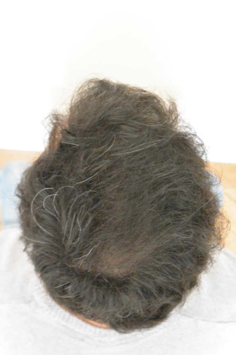 /foren/transplant/index.php/fa/44755/0/