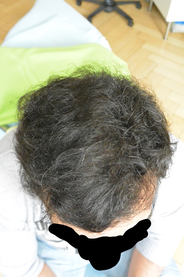 /foren/transplant/index.php/fa/44763/0/