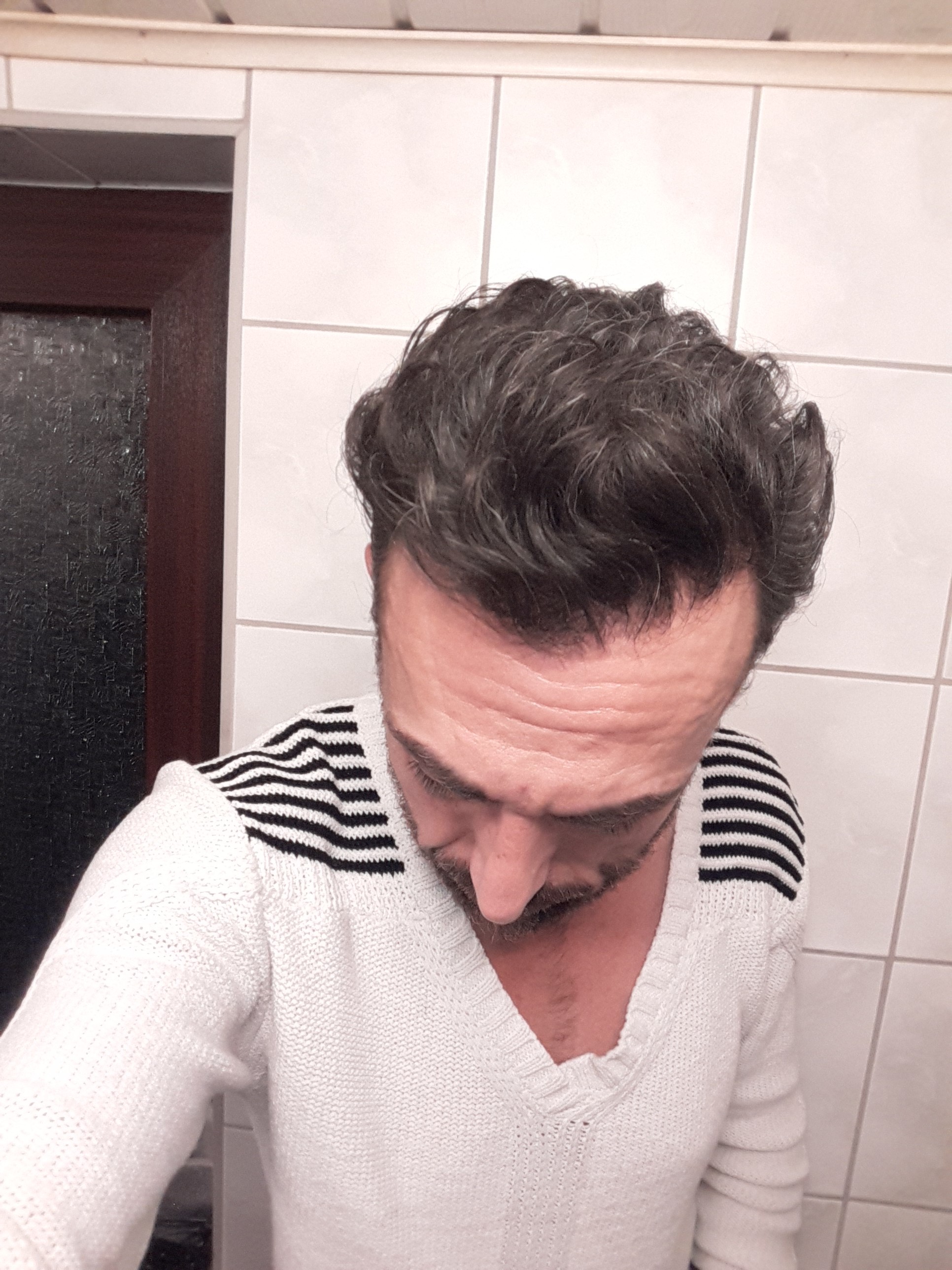 /foren/transplant/index.php/fa/44783/0/