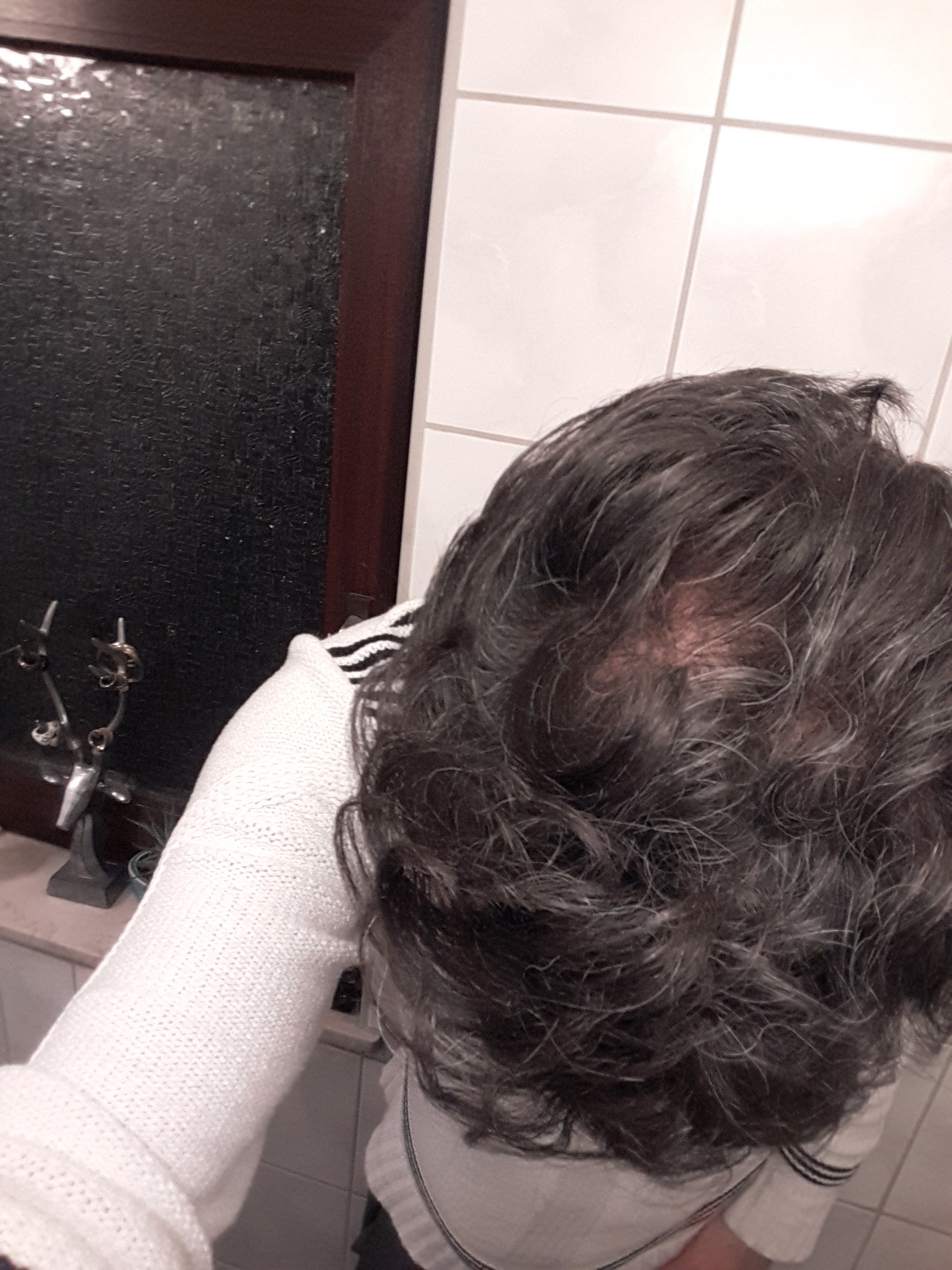 /foren/transplant/index.php/fa/44784/0/