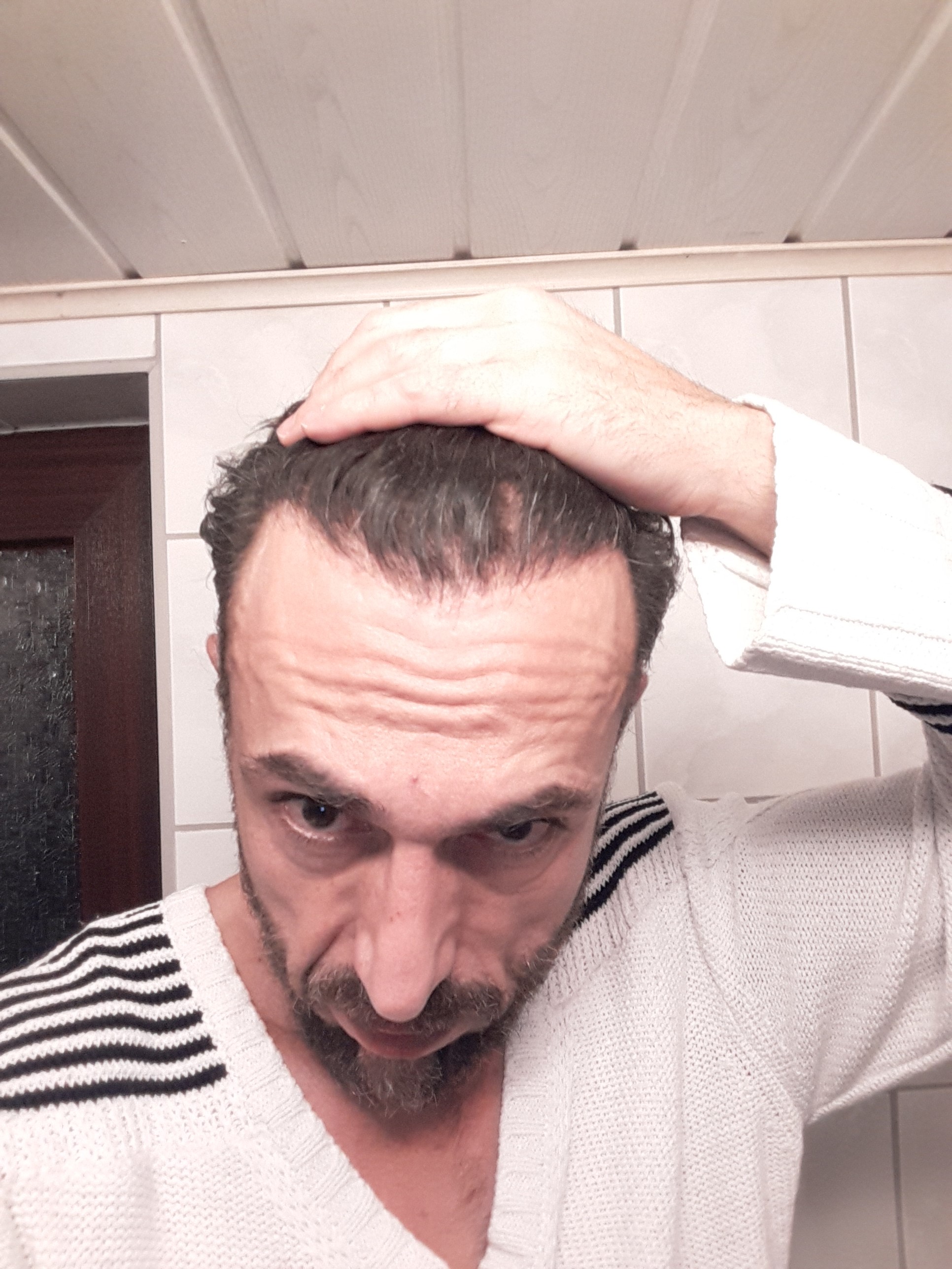 /foren/transplant/index.php/fa/44786/0/