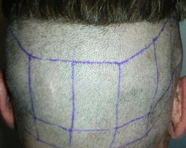 index.php/fa/4496/0/