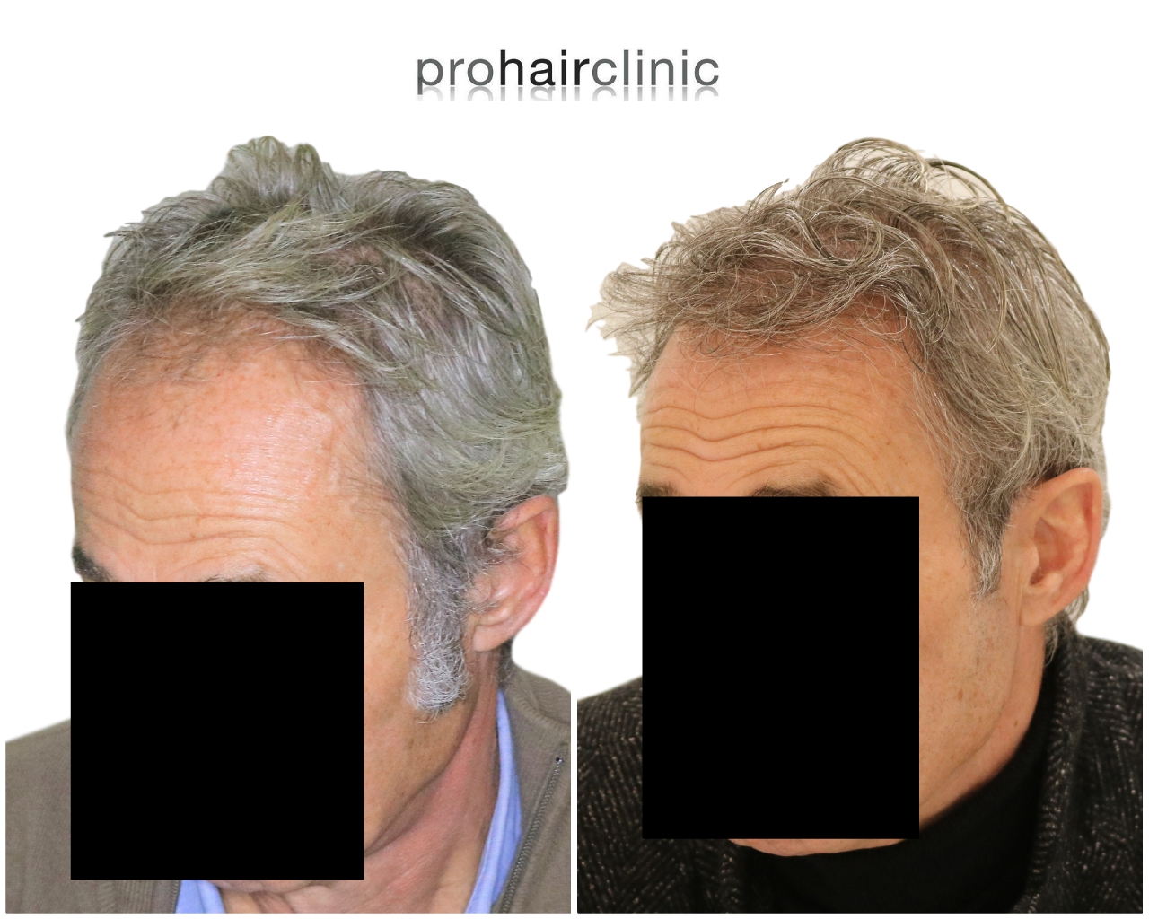 /foren/transplant/index.php/fa/44996/0/