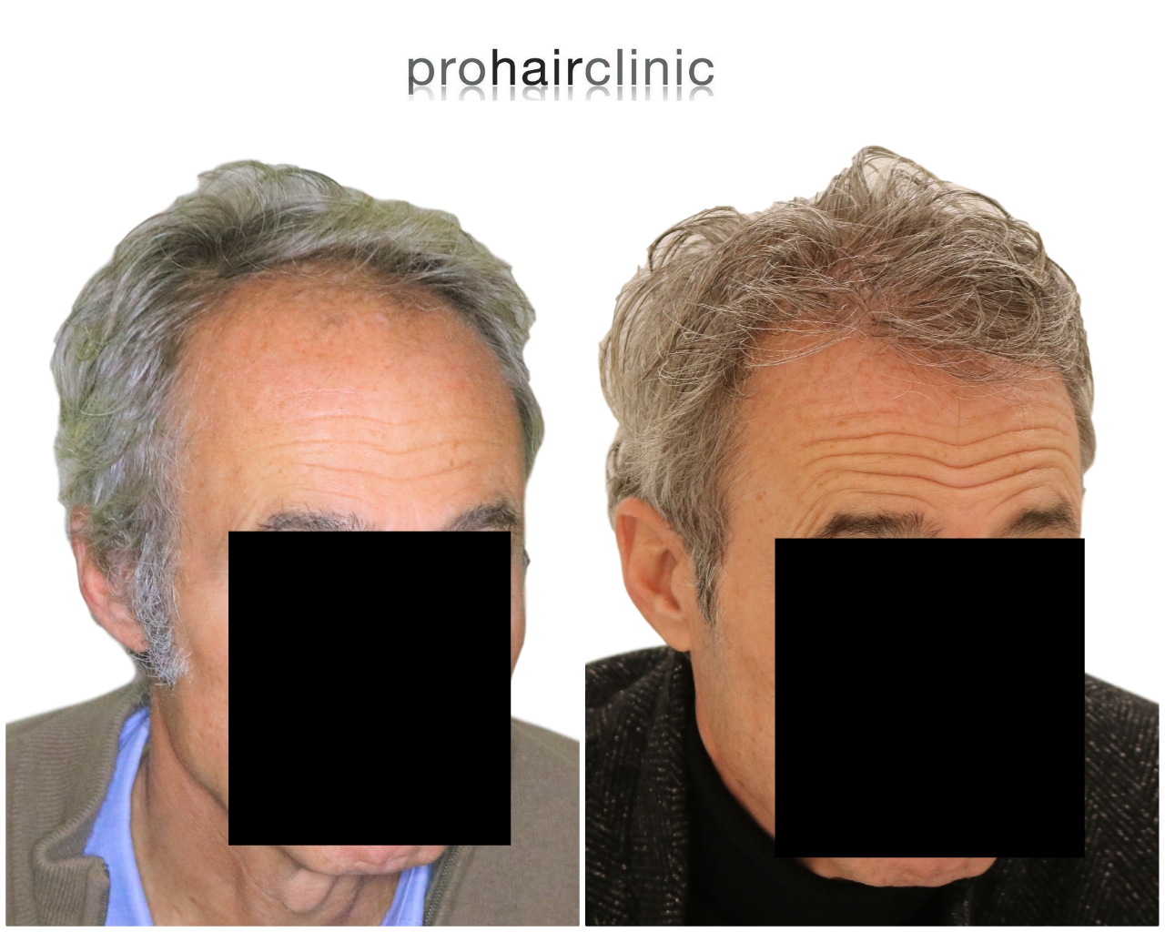 /foren/transplant/index.php/fa/44997/0/