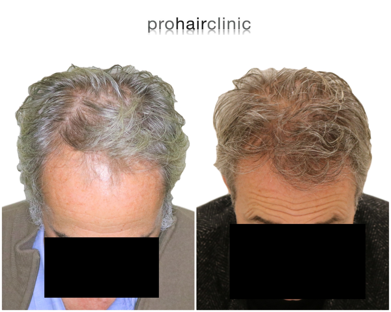 /foren/transplant/index.php/fa/44998/0/