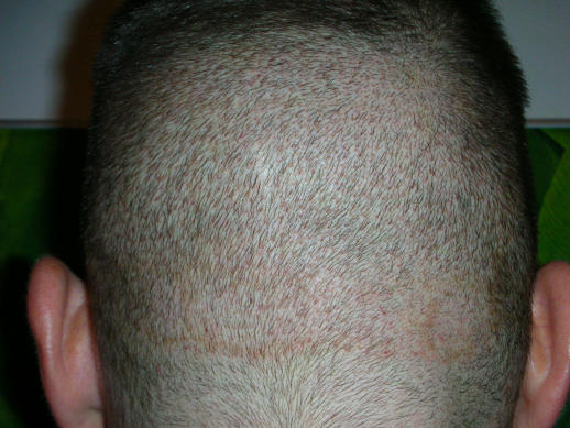 index.php/fa/4500/0/