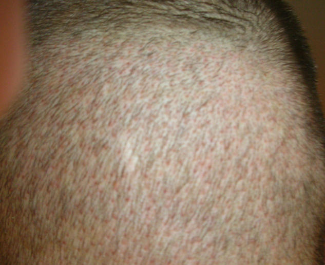 index.php/fa/4503/0/