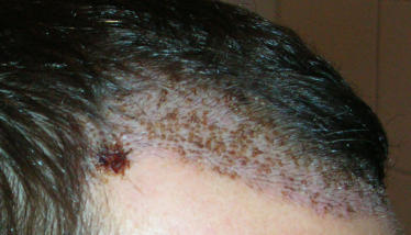 index.php/fa/4504/0/