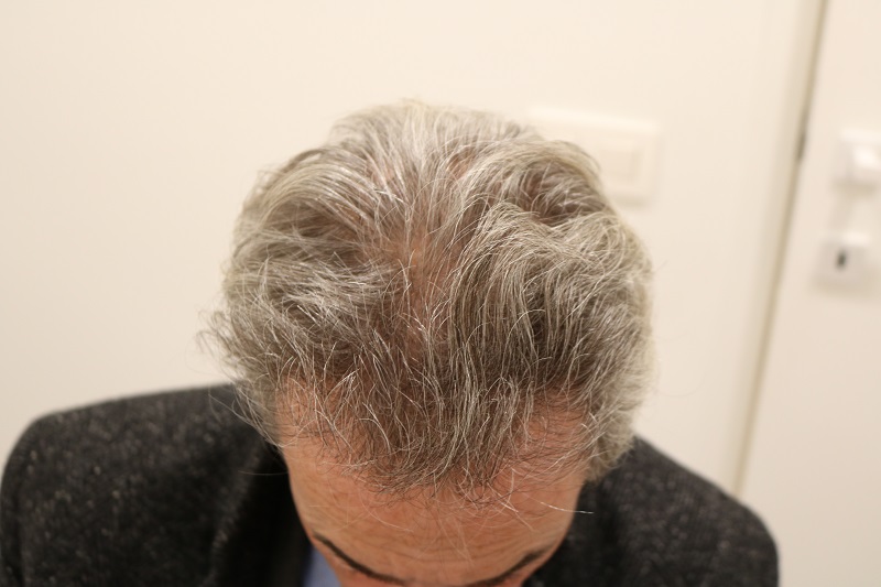 /foren/transplant/index.php/fa/45050/0/