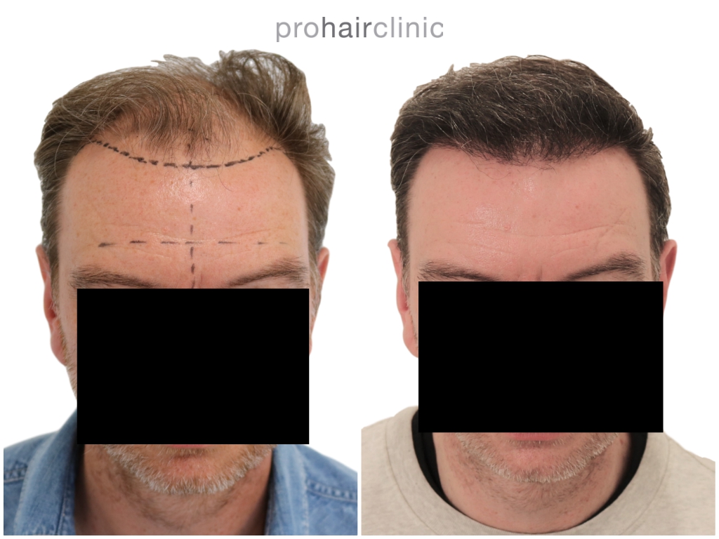 /foren/transplant/index.php/fa/45414/0/