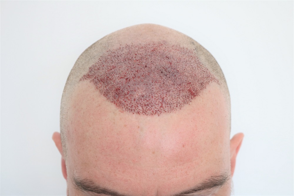 /foren/transplant/index.php/fa/45420/0/