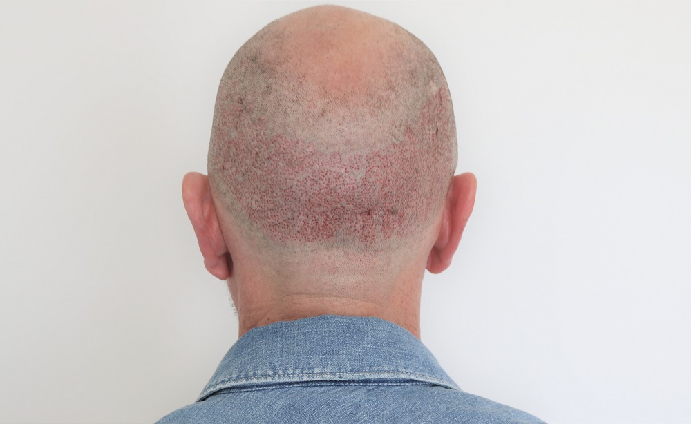 /foren/transplant/index.php/fa/45421/0/