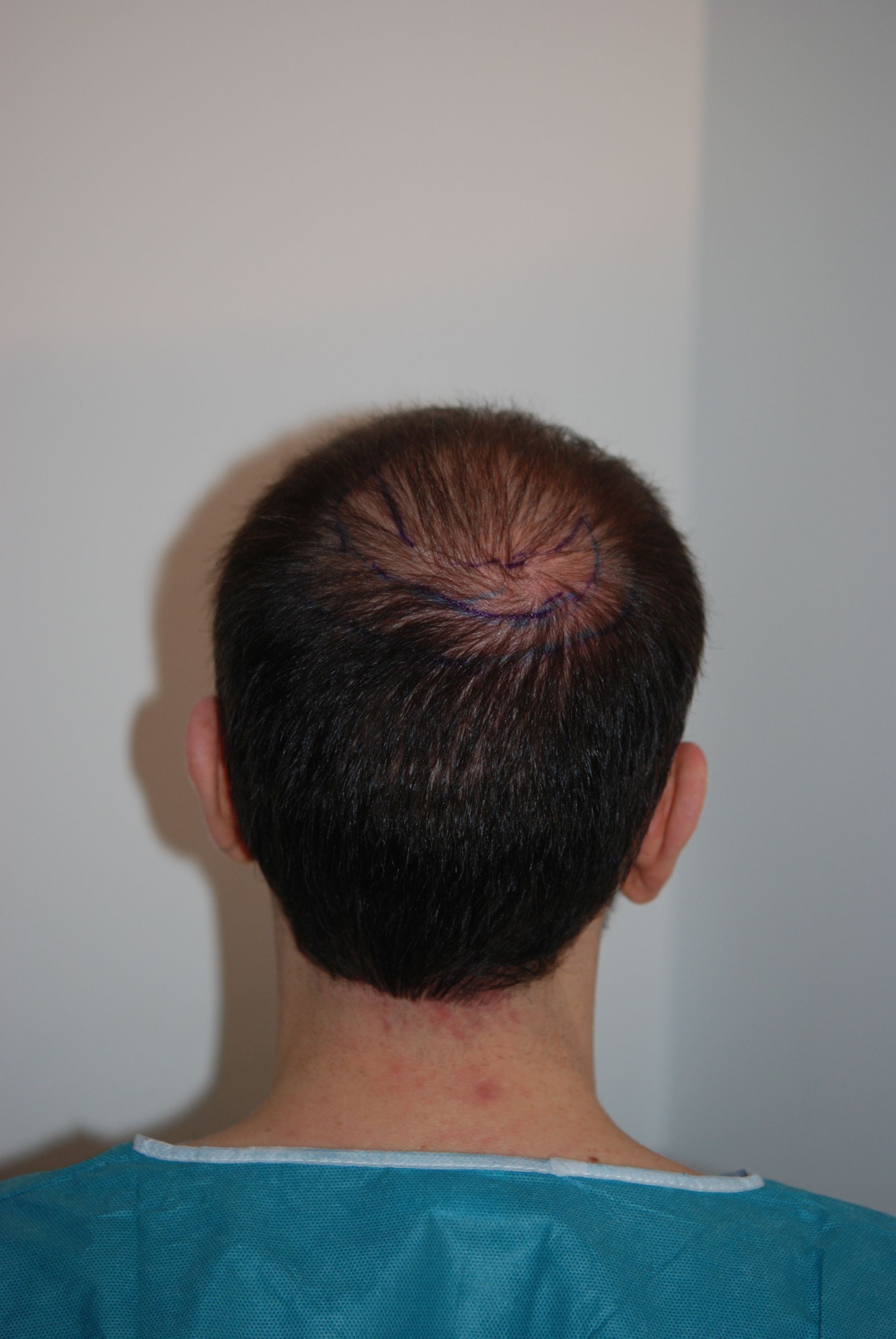 /foren/transplant/index.php/fa/45525/0/