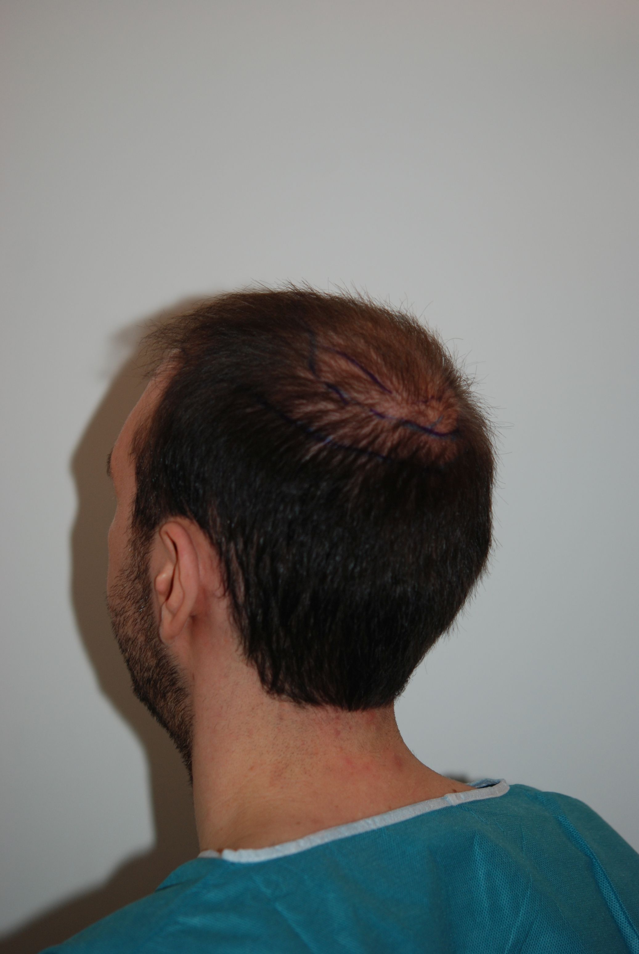 /foren/transplant/index.php/fa/45526/0/