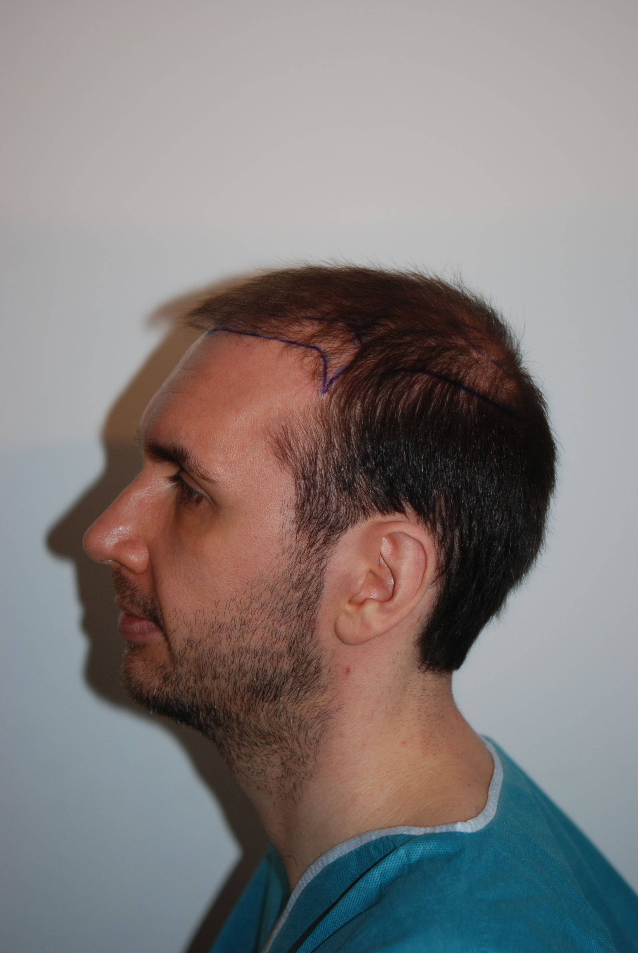 /foren/transplant/index.php/fa/45527/0/