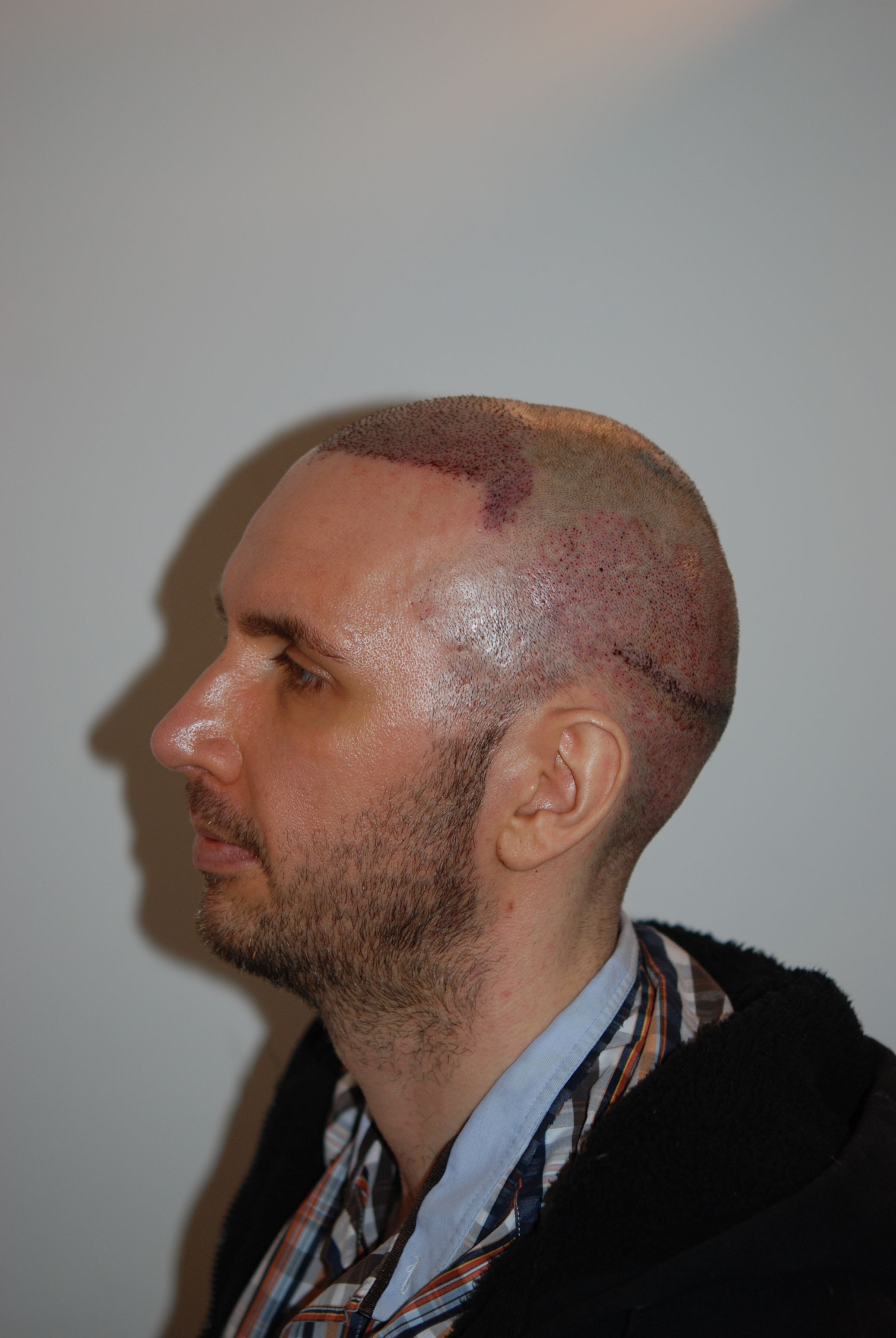 /foren/transplant/index.php/fa/45528/0/