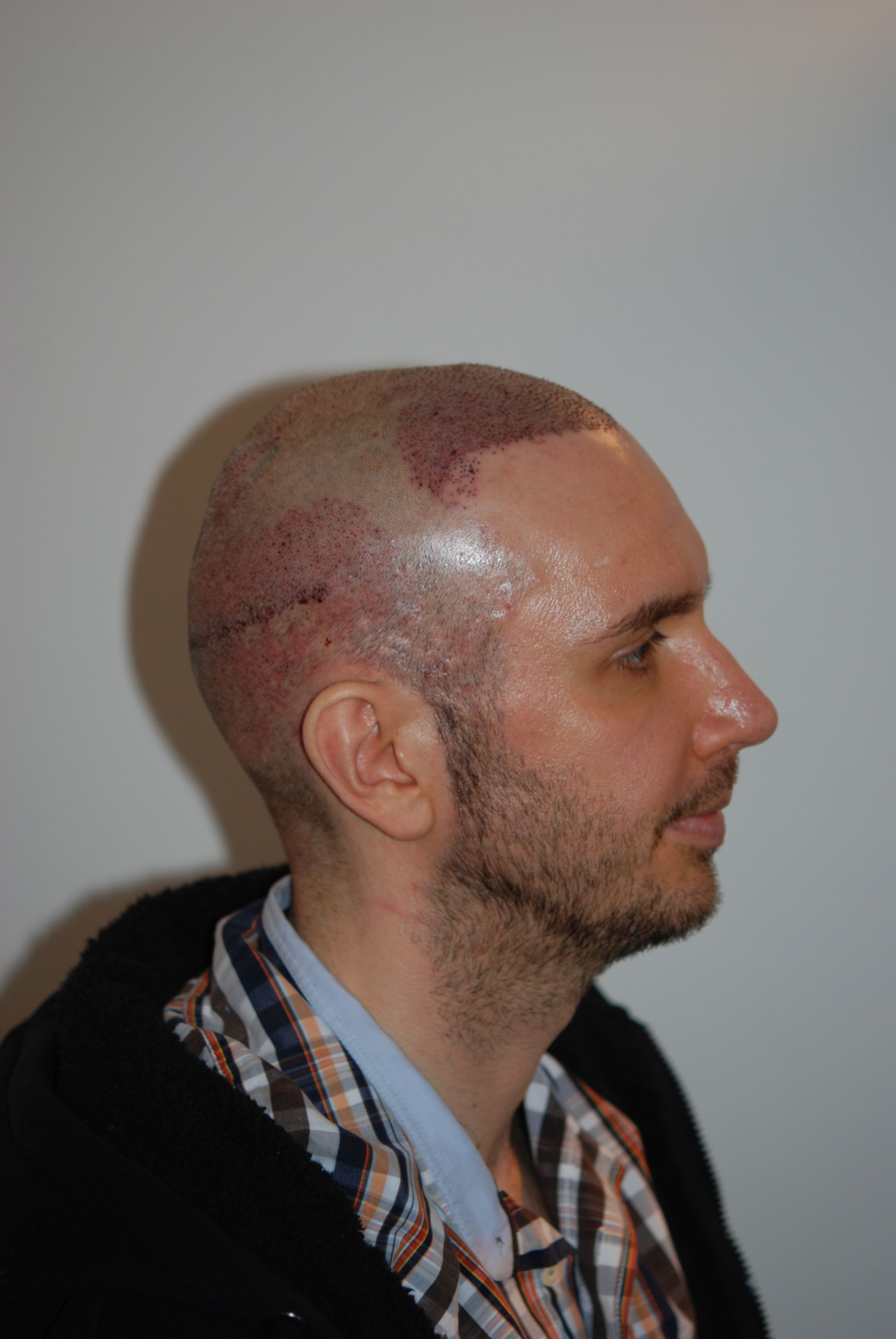 /foren/transplant/index.php/fa/45529/0/