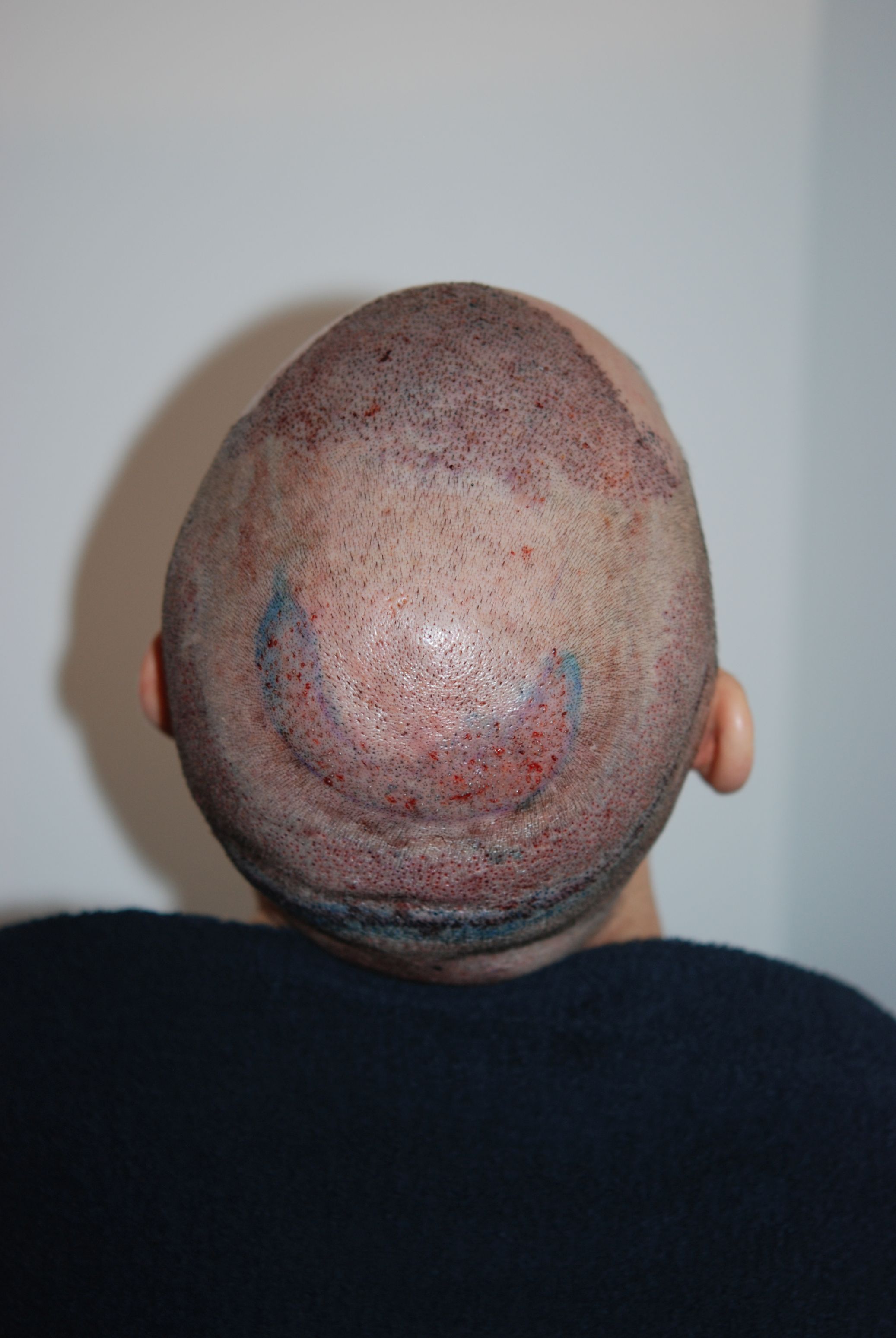 /foren/transplant/index.php/fa/45530/0/