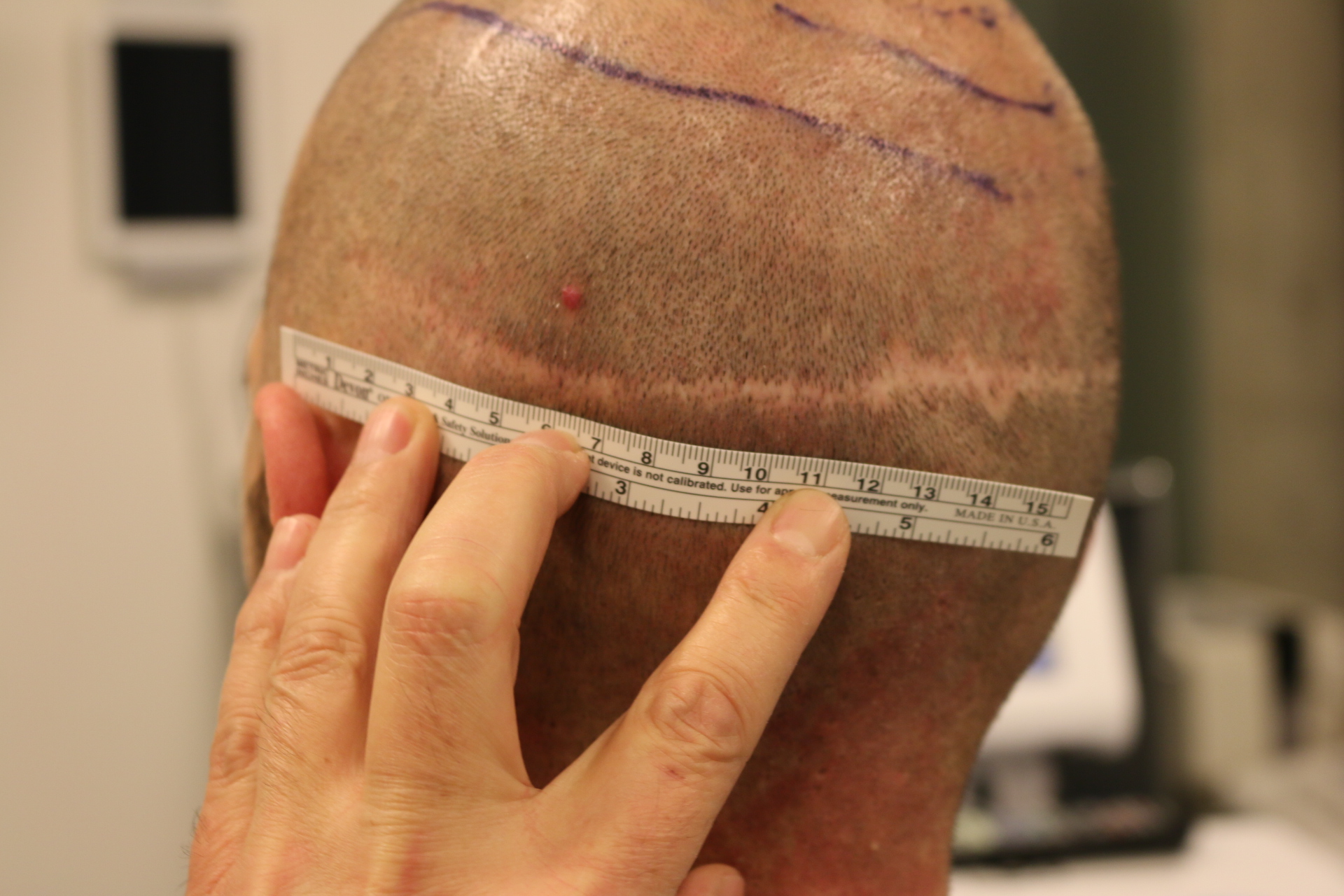 /foren/transplant/index.php/fa/45532/0/