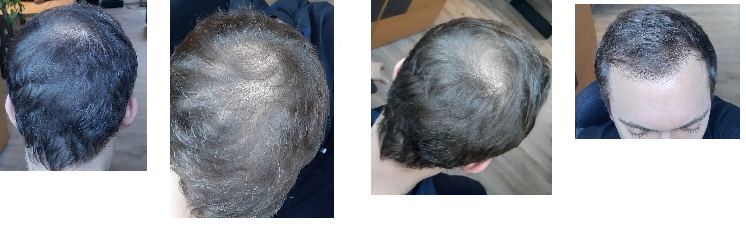 /foren/transplant/index.php/fa/45562/0/