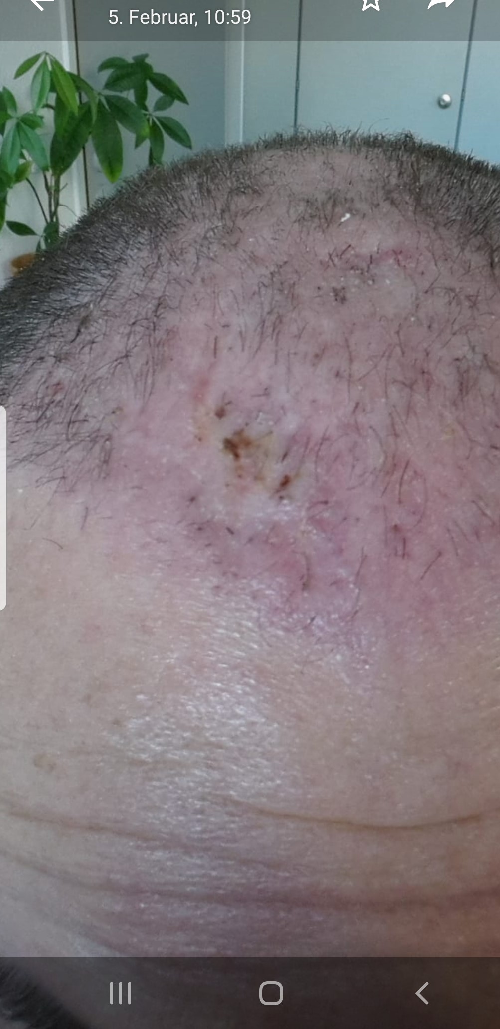 /foren/transplant/index.php/fa/45638/0/