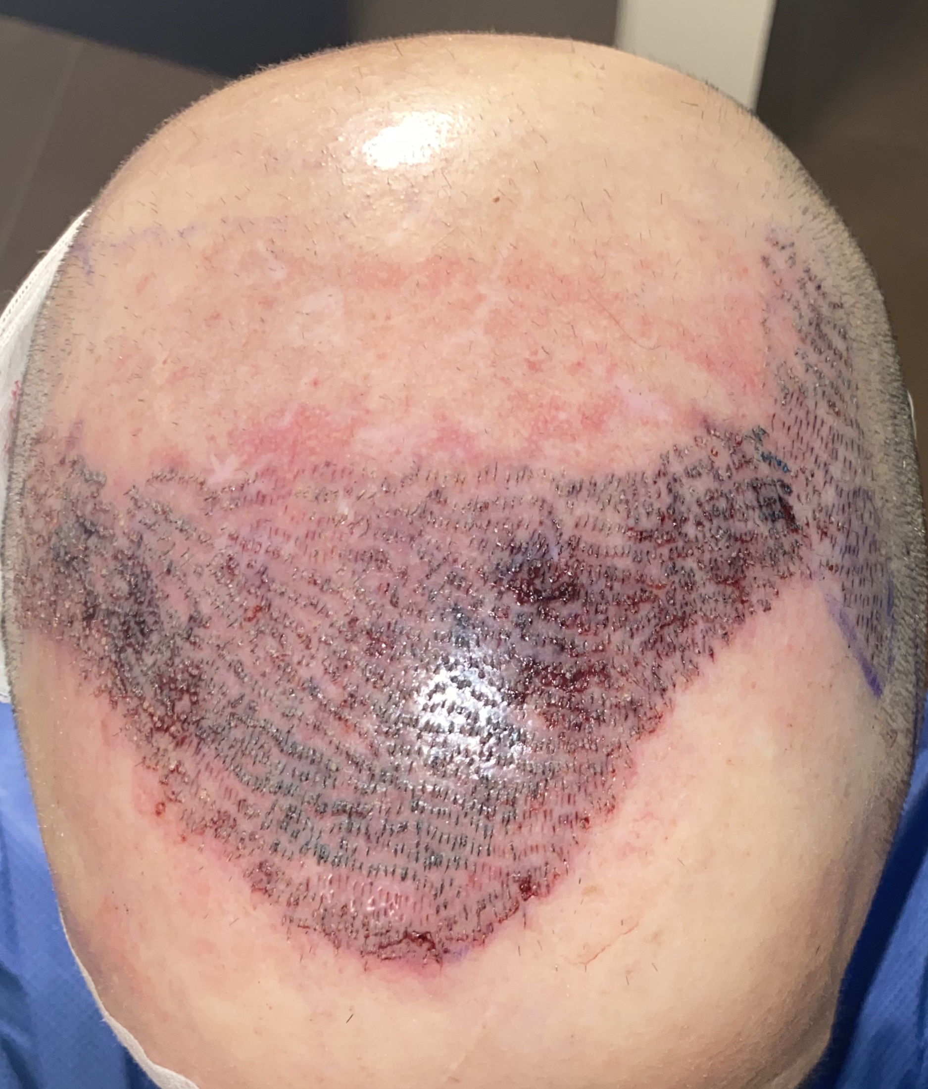 /foren/transplant/index.php/fa/45815/0/