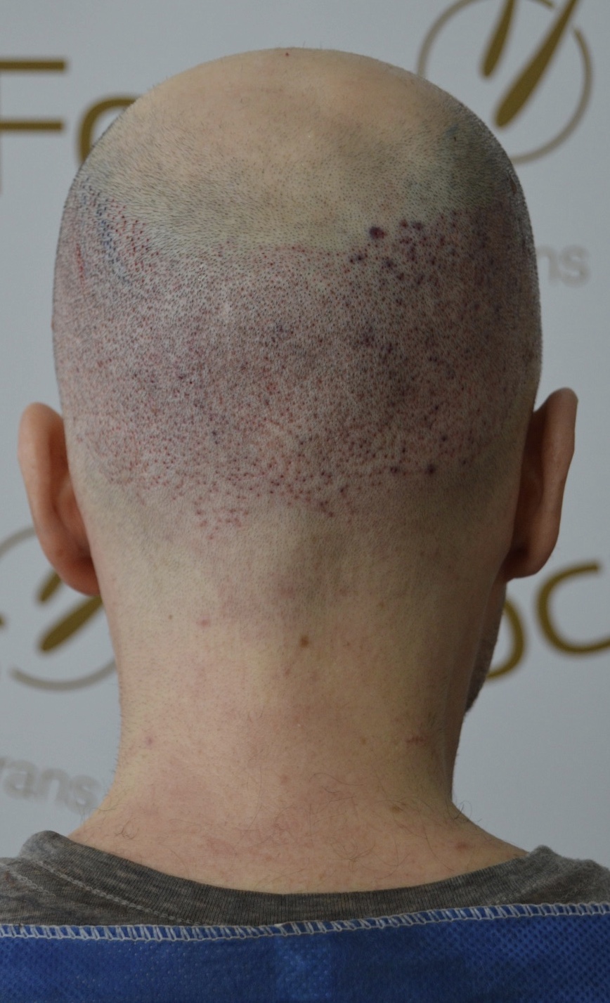 /foren/transplant/index.php/fa/45817/0/