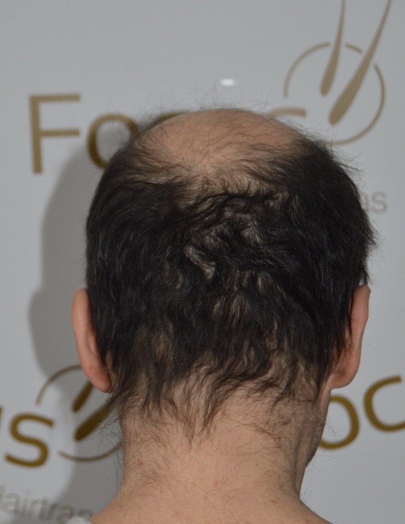 /foren/transplant/index.php/fa/45849/0/