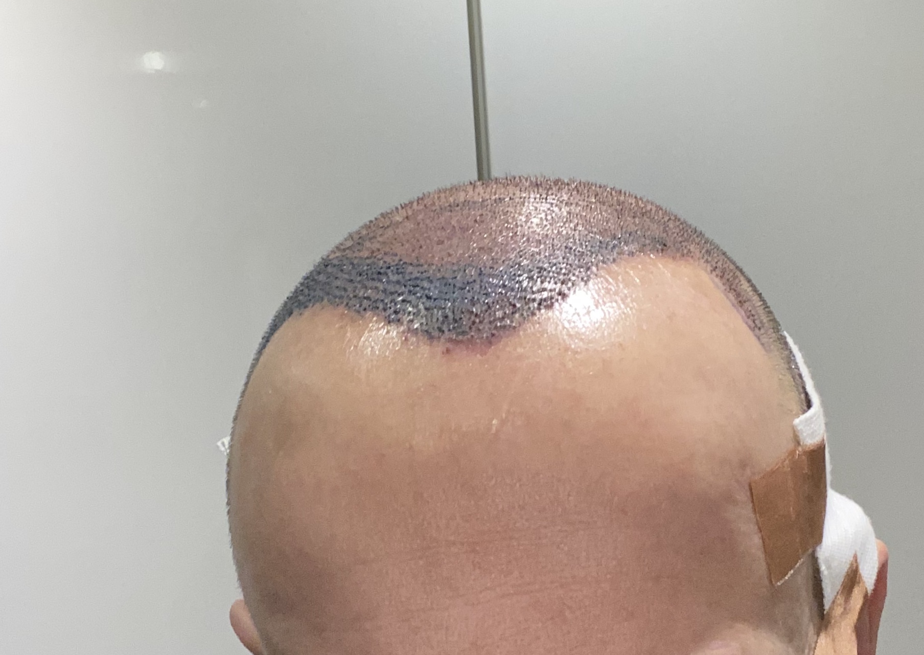 /foren/transplant/index.php/fa/45851/0/